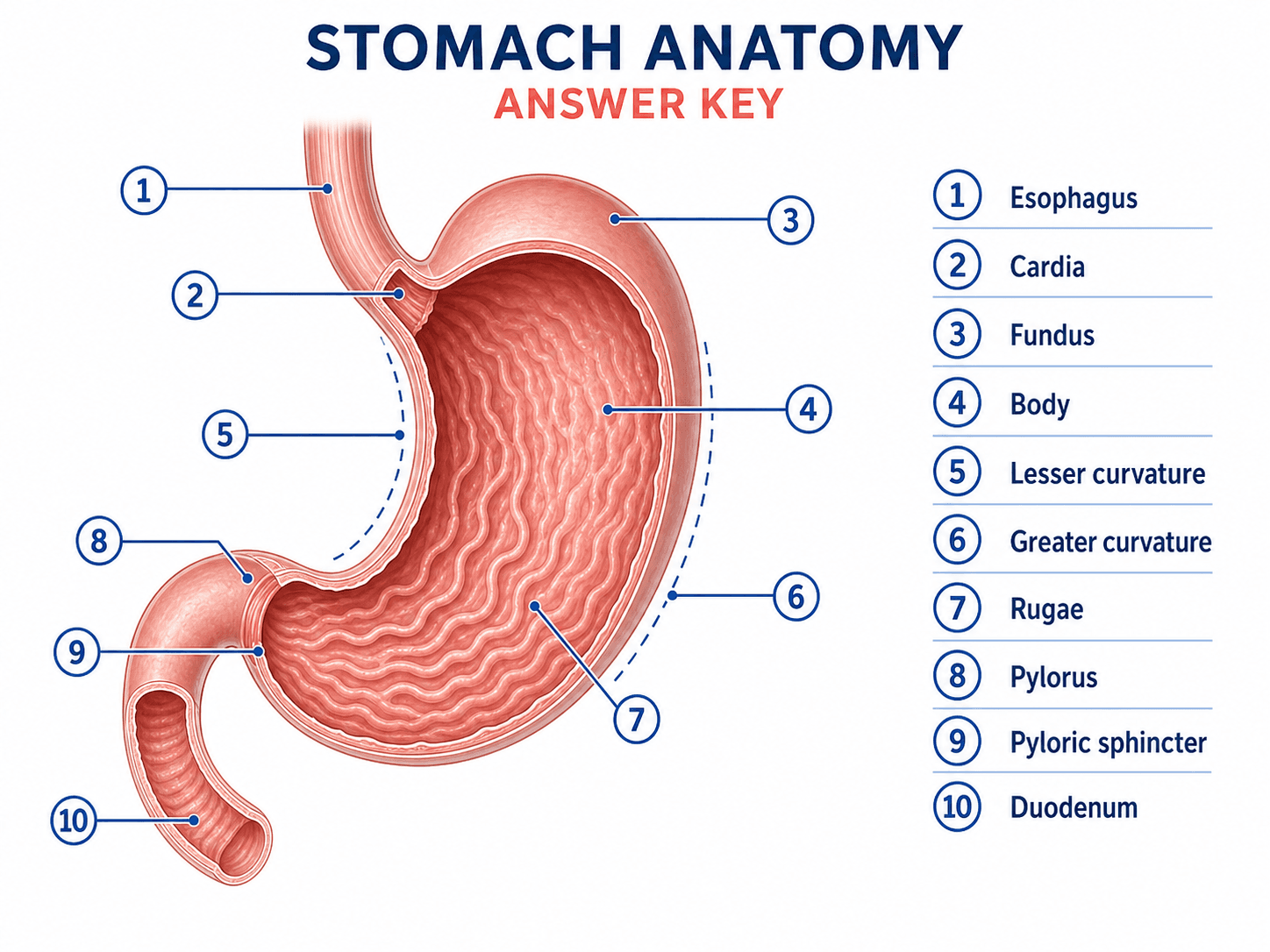Chiave di risposta del diagramma dello stomaco — Legenda delle risposte con etichette corrispondente per la scheda dello stomaco in bianco.