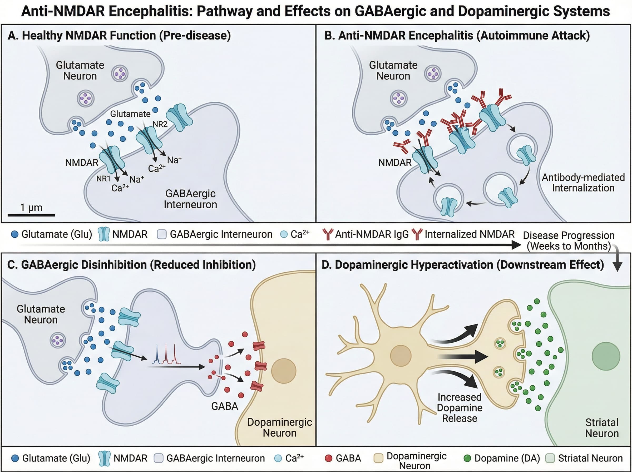 biomedical scientific illustration: Illustration of the pathogenic pathway of anti-NMDAR encephalitis and its effect on GABAergic and dopaminergic neurotransmission.