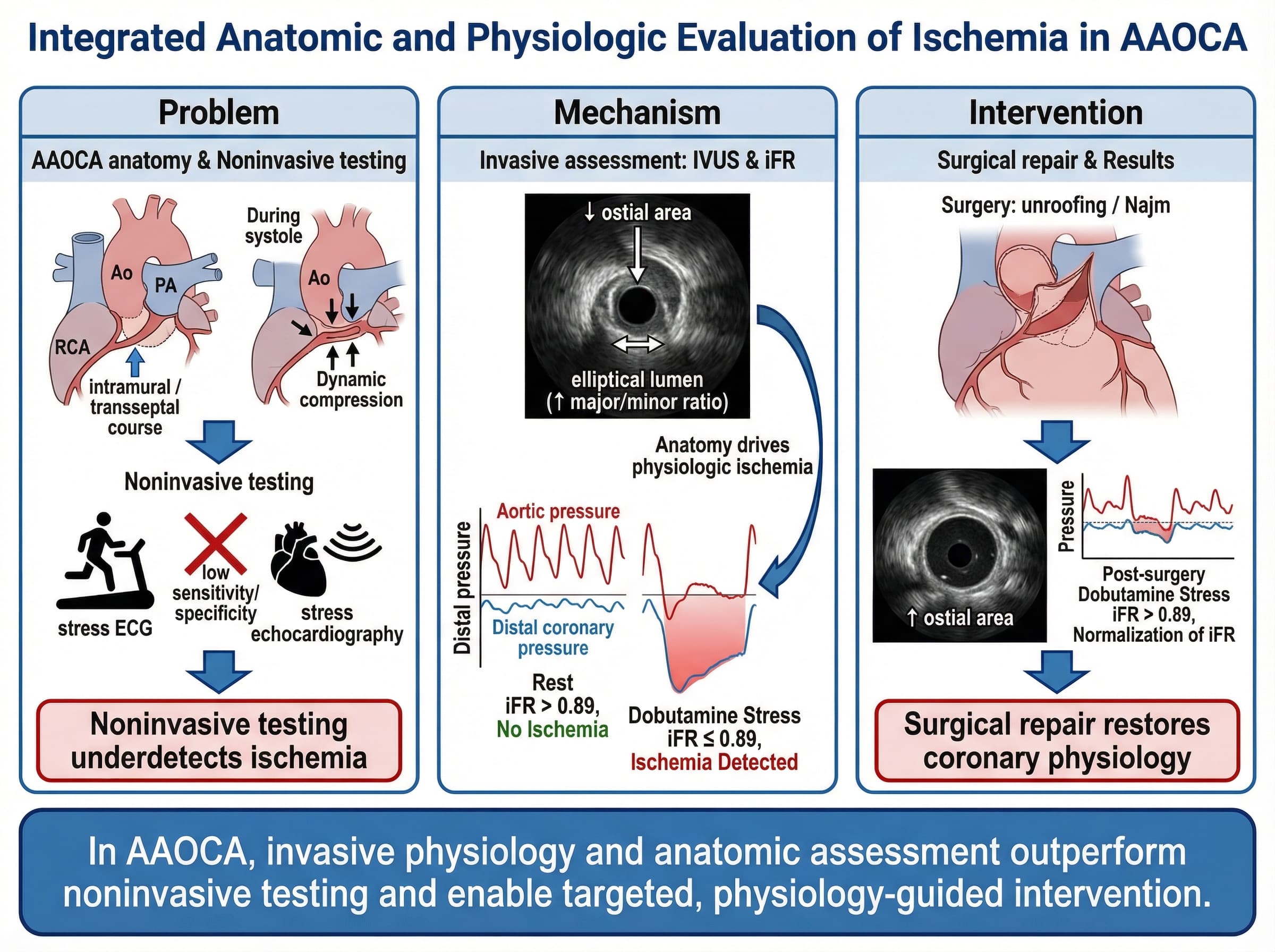 biomedical scientific illustration: Integrated anatomic and physiologic evaluation of ischemia in AAOCA, structured as a JACC-style three-panel central illustration.