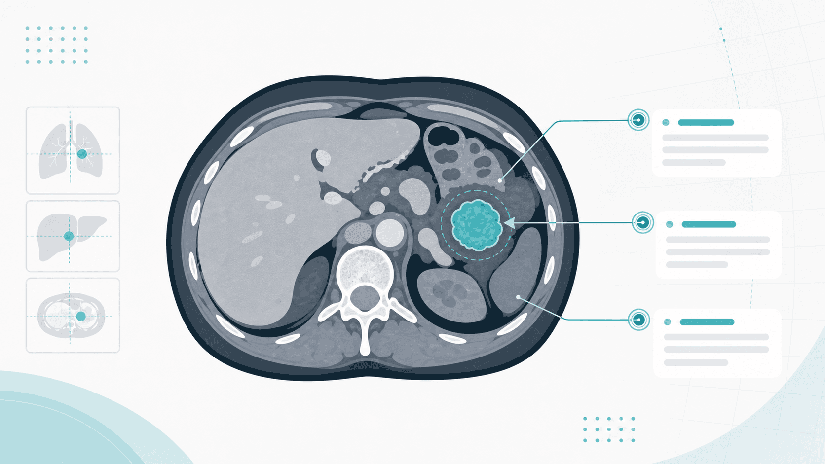 Medizinische Bildannotation: Läsionen auf CT, MRT und Thorax-Röntgen beschriften Medizinische Bildannotation: Läsionen auf CT, MRT und Thorax-Röntgen beschriften